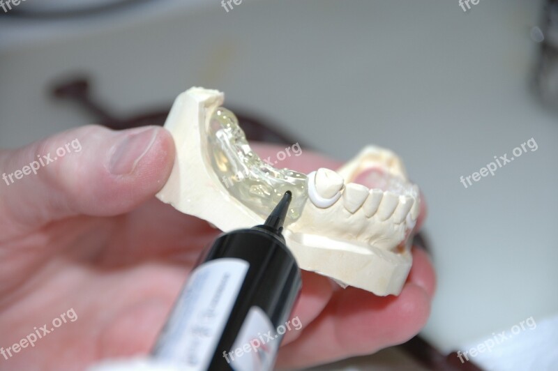 Zahntechnik Plastic Prosthesis Dental Laboratory Tooth Replacement