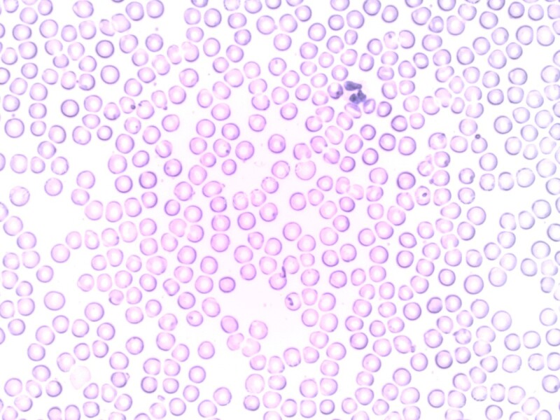 Blood Neutrophil Segmented Neutrophil Granulocyte Blood Cell