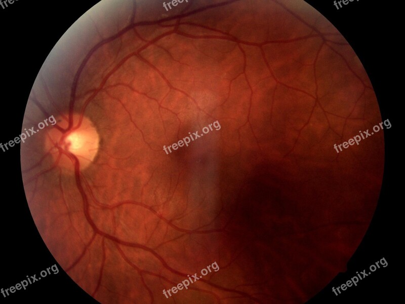 Eye Eyeball Medical Nerve Free Photos