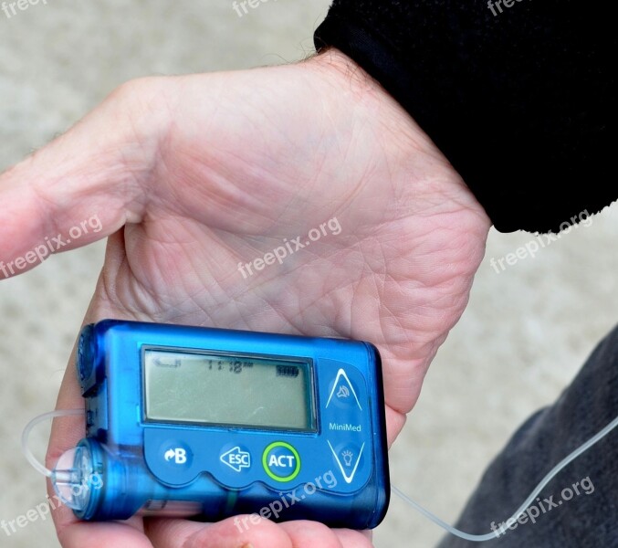 Diabetes Insulin Pump Diabetic Medicine