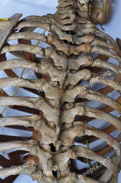 Bones Skeleton Back Spine Human