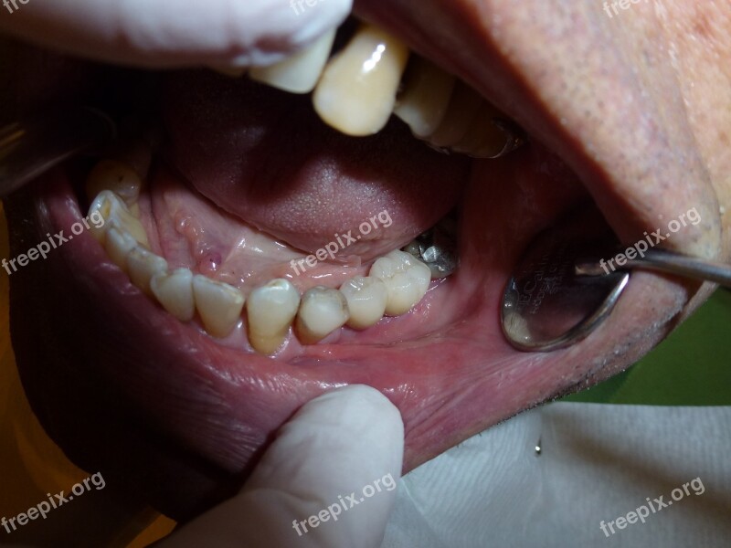 Implant Dentistry Dentist Teeth Surgery