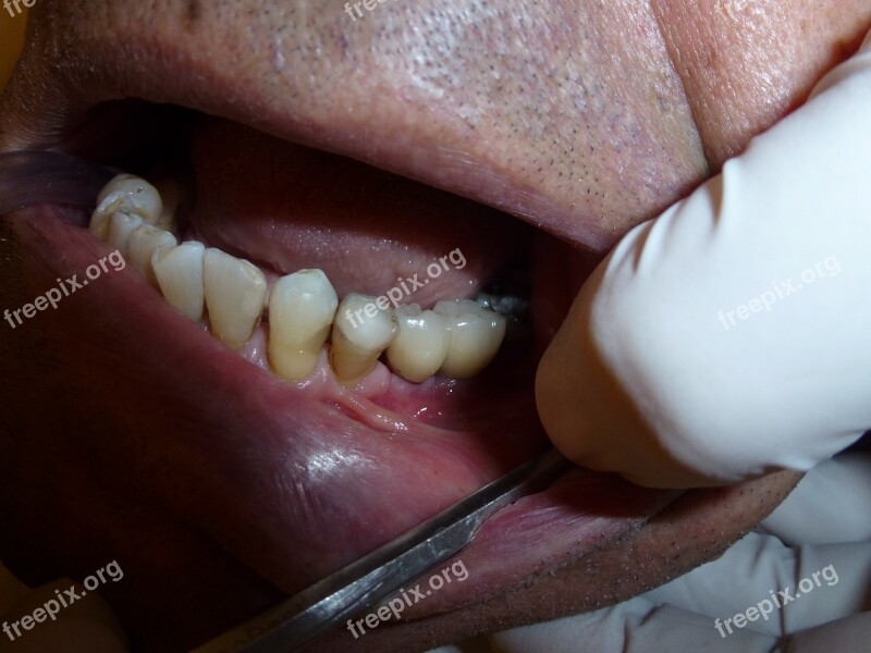 Implant Dentistry Dentist Teeth Surgery