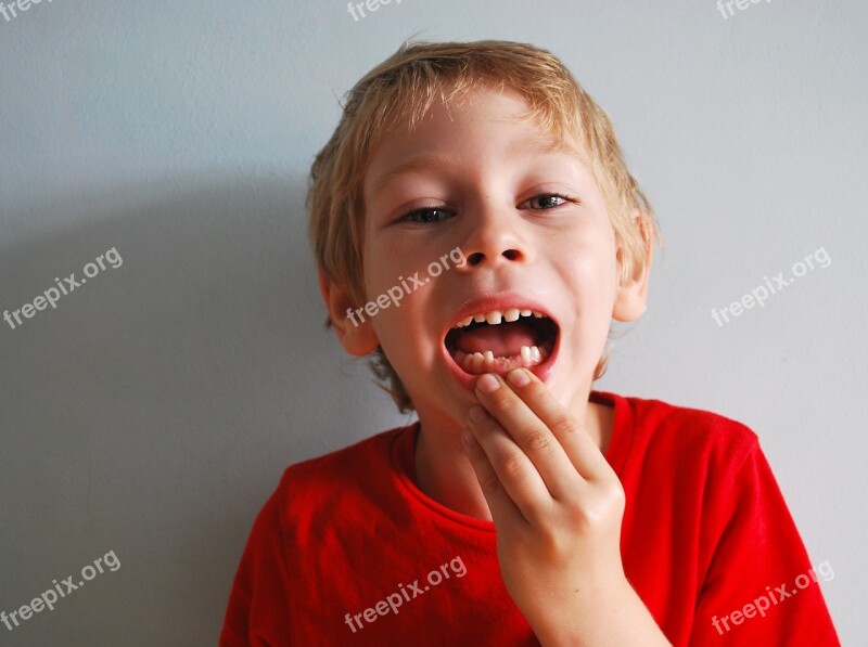 Baby Teeth Without Boy Mouth Showing