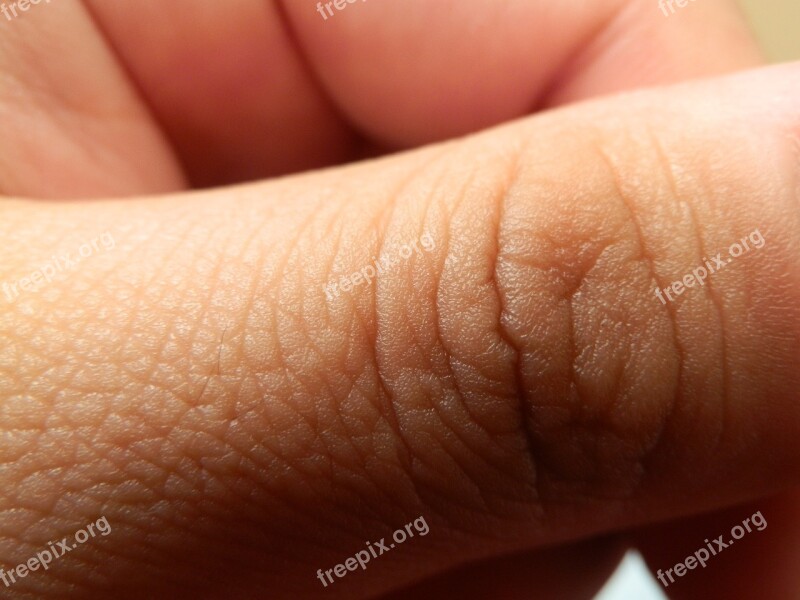 Finger Skin Hand Free Photos