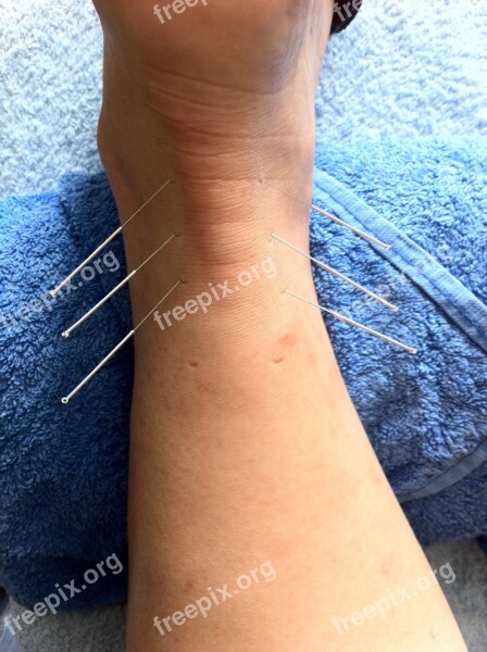 Acupuncture Sport Injury Sports Massage Alternative Injured