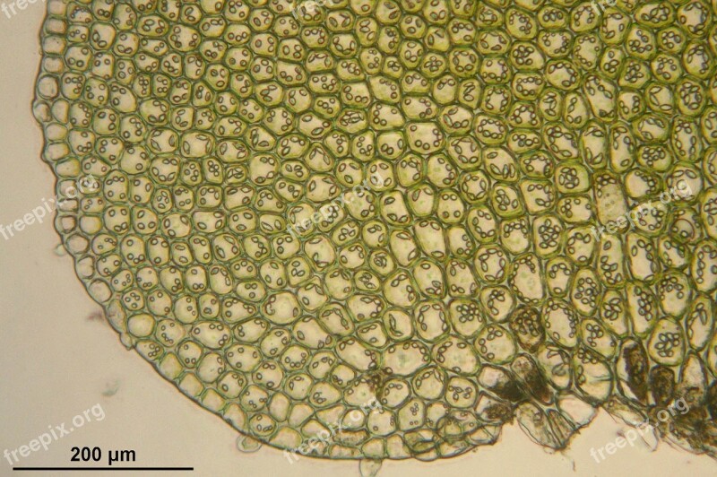 Bazzania Trilobata Microscopic Cells Biology Macro