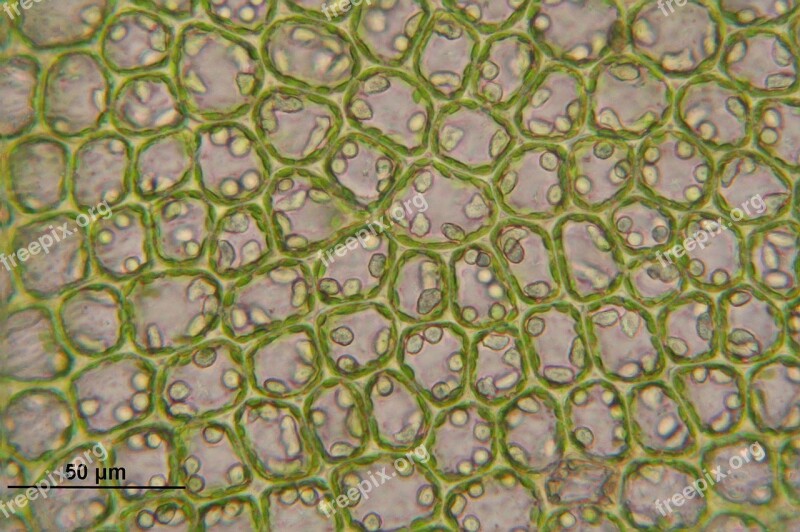 Barbilophozia Floerkei Cells Liverwort Microscopic Macro