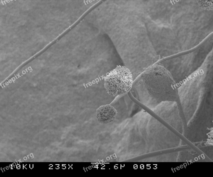 Mold Aspergillus Scan 235 Magnifications