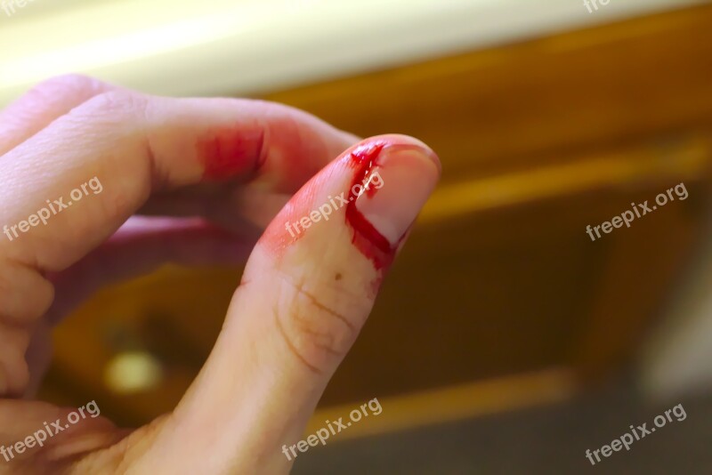 Accident Bleed Bleeding Bleeding Finger Blood