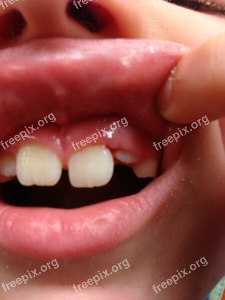 Teeth Mouth Dental Free Photos