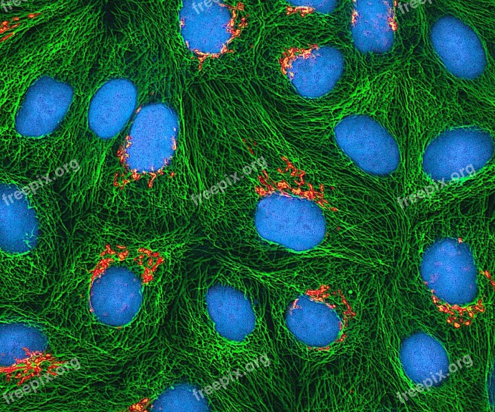 Hela Cells Cultured Electron Microscope Stained Fluorescent Protein