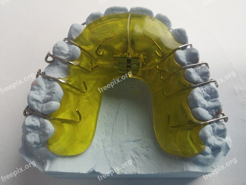 Dental Braces Dentist Orthodontics Dental Rail Rails