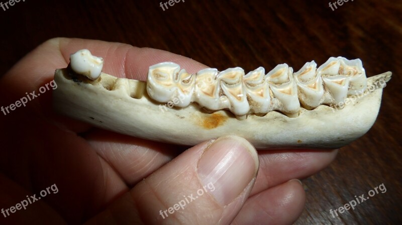 Teeth Tooth Dental Caries Bone Skeleton