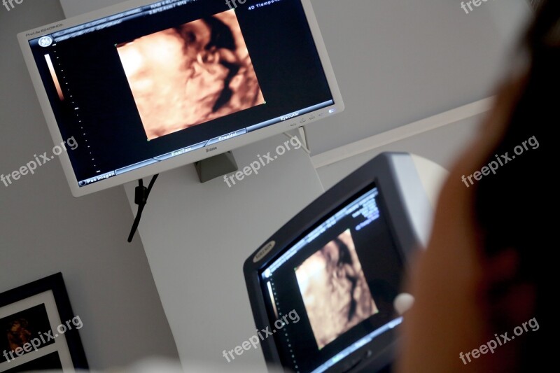 Monitor Ultrasound Medical Consultation Diagnosis Consultation