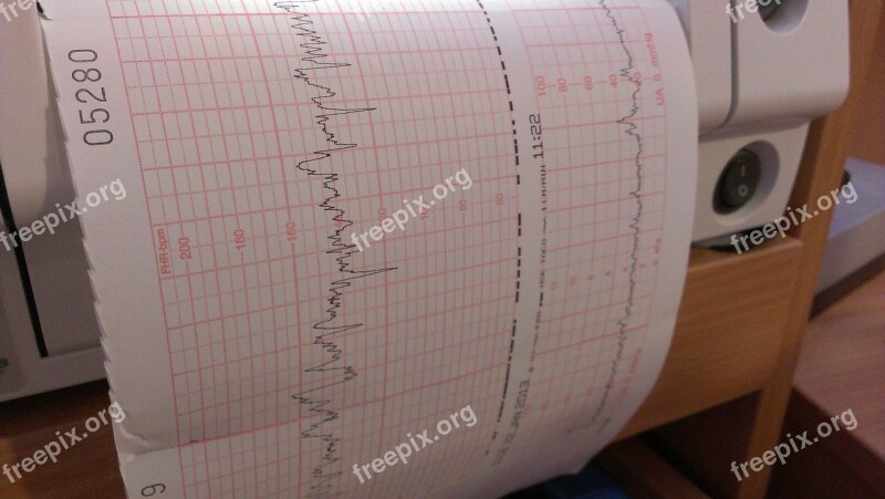 Doppler Ultrasound Investigation Chart Evaluation Pregnant