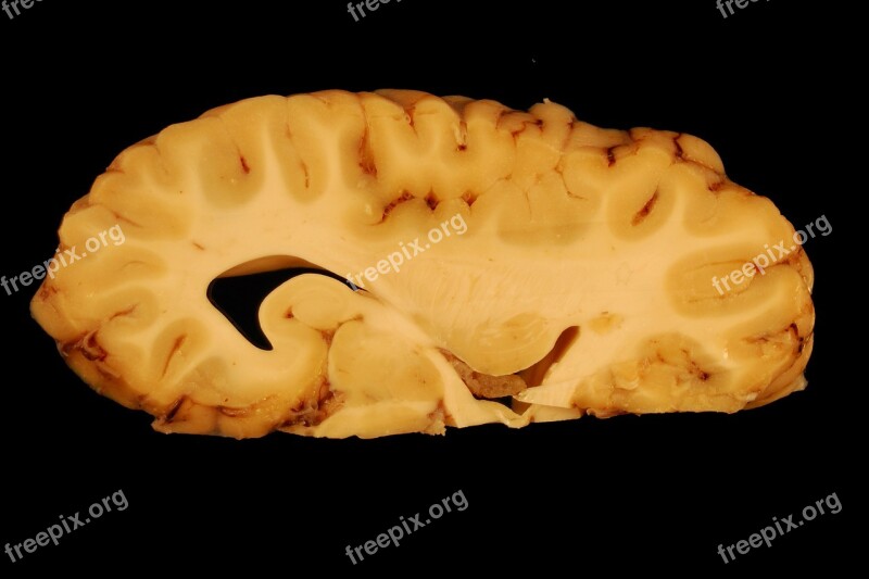 Brain Anatomy Eyes Paerparat Horse