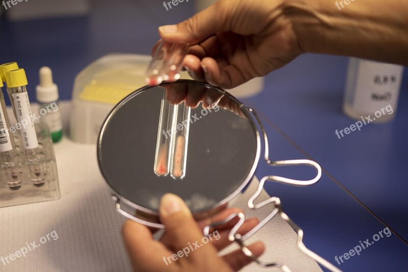 Blood Sample Analysis Laboratory Test