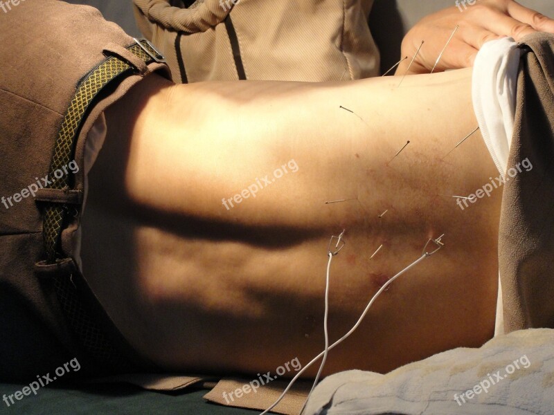 Acupuncture Man Needles Therapy Health